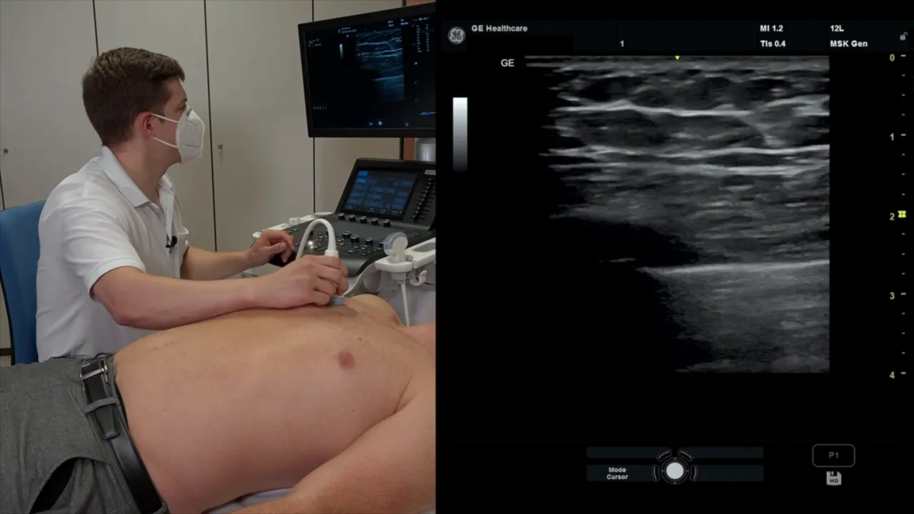 Transducer wird auf dem höchsten Punkt der Brust platziert