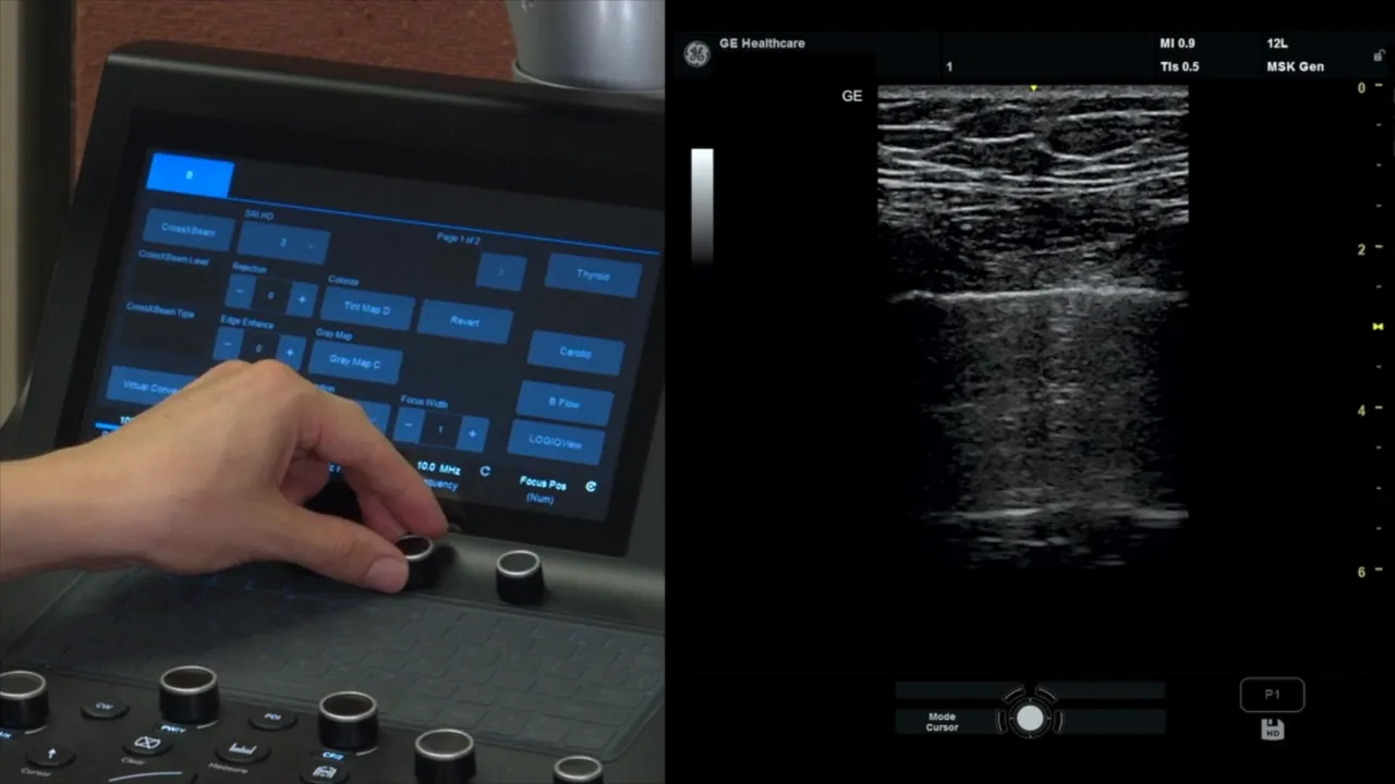 Frequenzeinstellung wird auf etwa 10 MHz festgelegt