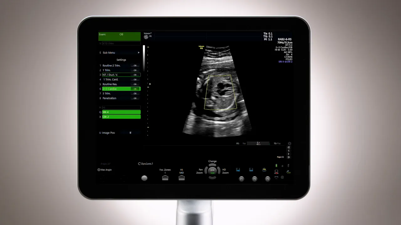 Voluson P8 Monitor mit markiertem ROI und hervorgehobener pos/size-Steuerung am Display