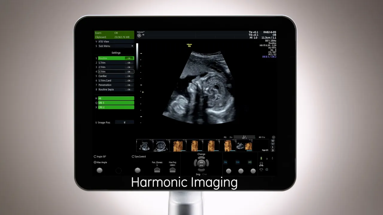 Voluson P8 Monitor mit deutlich sichtbarem Ultraschallbild und Schriftzug 'Harmonic Imaging'.
