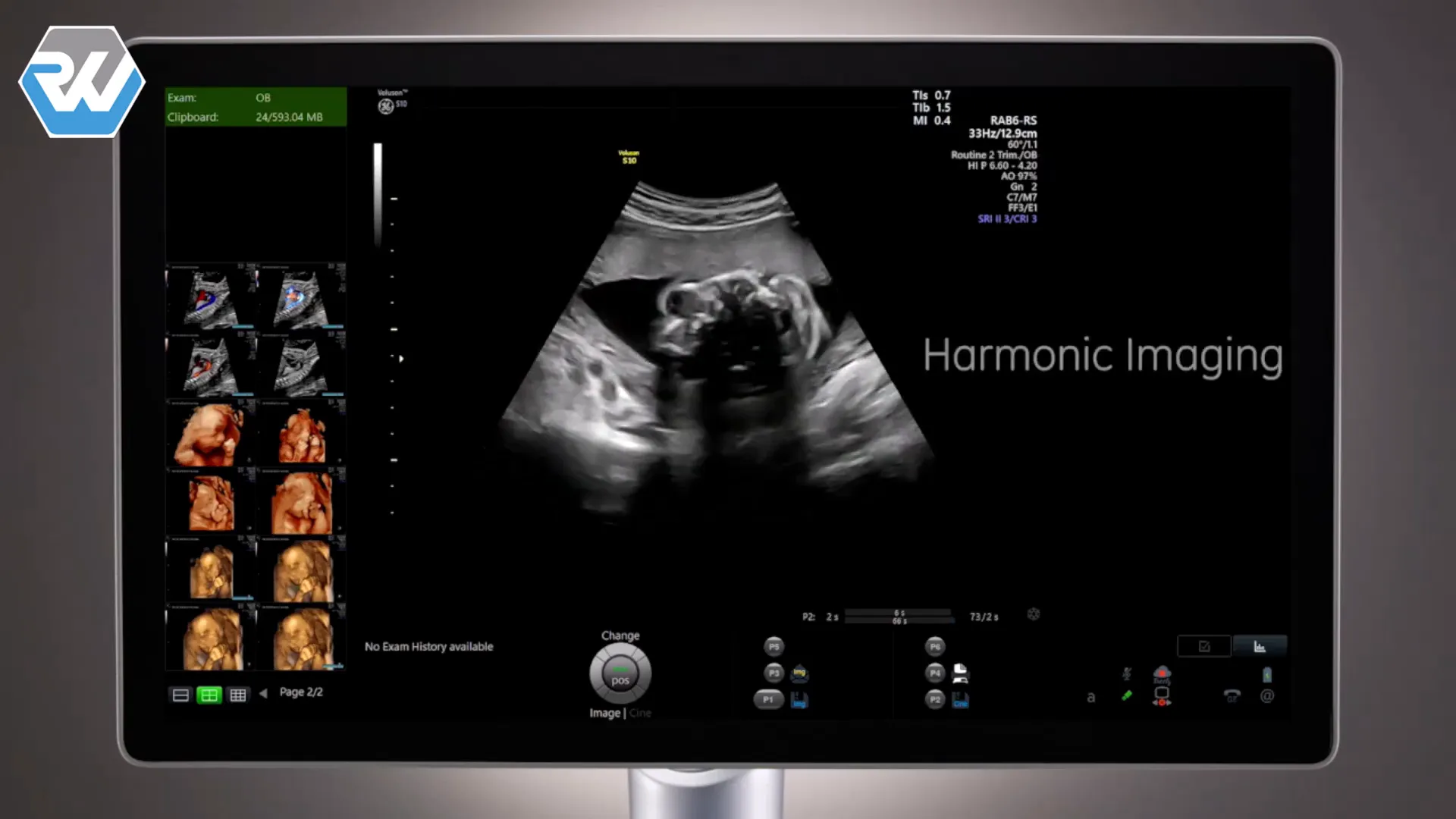 Aktivierung des Harmonic Imaging
