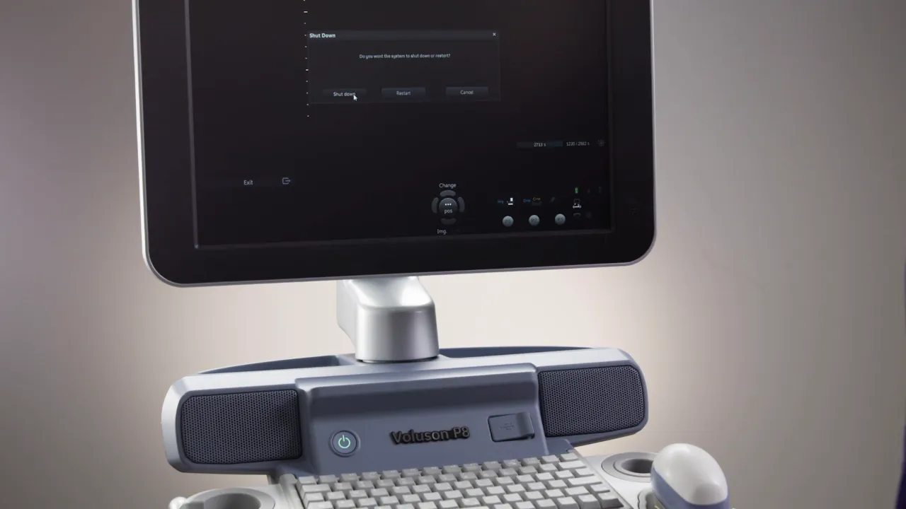 Voluson P8 Monitor mit Shutdown-Dialog und sichtbarer Power-Taste auf der Konsole.