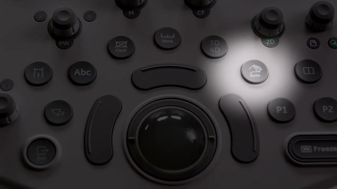 Trackball und umgebende Tasten des Voluson P8 mit hervorgehobenem Auto-Button