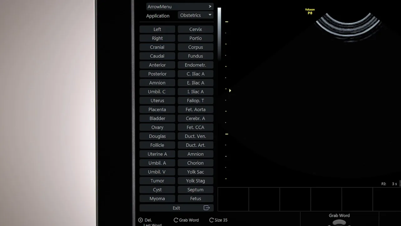 Voluson P8 Display Anzeige mit Liste von Annotationen und Wortoptionen