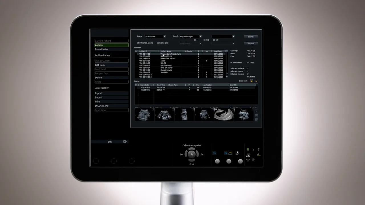 Voluson P8 Monitor zeigt die Archivverwaltung mit Patientenliste, Untersuchungsdetails und Bildminiaturen