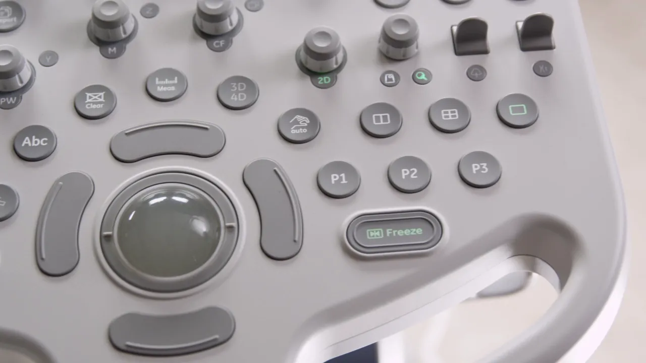 Bedienfeld des Voluson P8 mit sichtbarer Freeze-Taste und P1–P3 Hard Keys