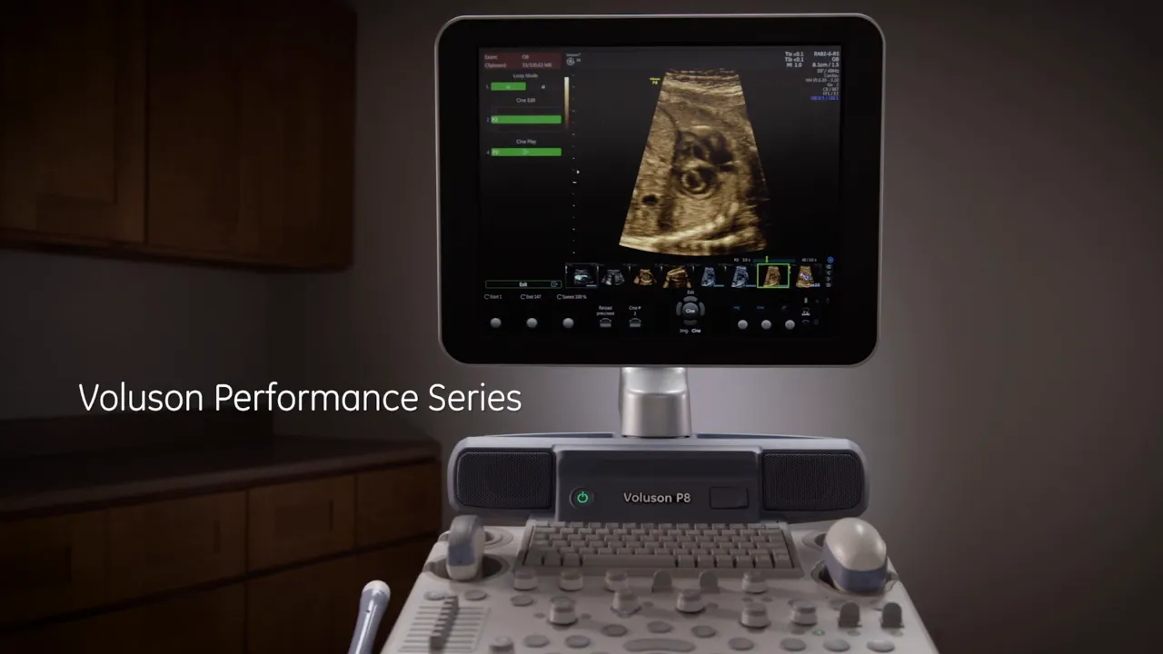 Voluson P8 Ultraschallsystem: Monitor mit Bild und die Bedieneinheit der Konsole in einer klaren Gesamtaufnahme.