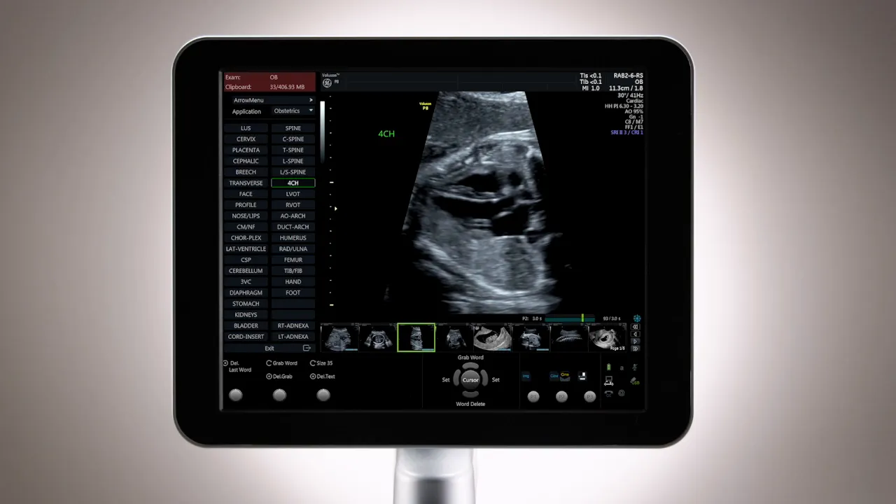 Bildschirm des Voluson P8 mit geöffnetem Arrow/Wort‑Menü für Annotationen; '4CH' ist grün markiert.