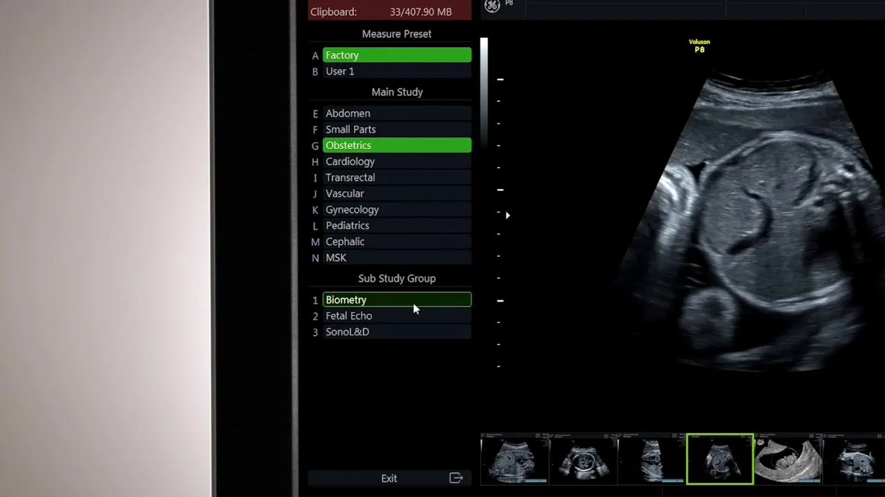 Nahaufnahme des Voluson P8 Displays mit ausgewähltem Messpreset 'Obstetrics' und Sub-Study 'Biometry'