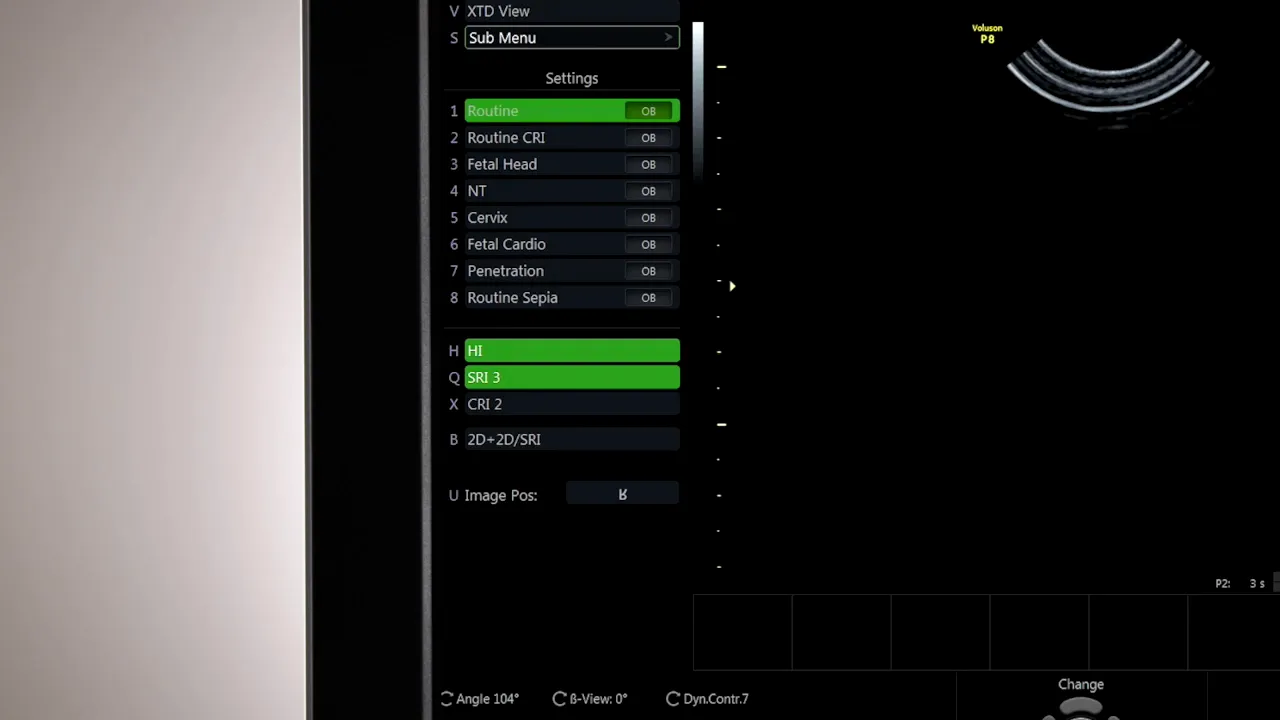 Voluson P8 Menü mit nummerierter Preset‑Liste und sichtbaren Shortcuts