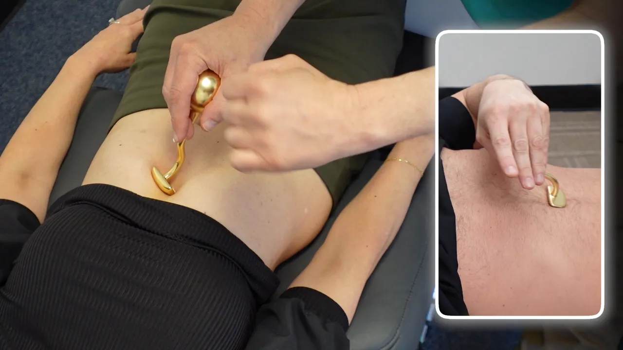 Placing the Reflux Shield at an angle following the ribs