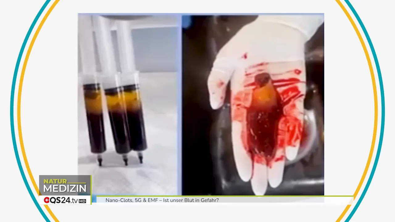 Kann Blut durch 5G verklumpen? Interview mit Dr. Diana Henz & Jörg Hentschel, Kognitions‑ und Neurowissenschaftlerin & Heilpraktiker/Forscher 4 Ampullen und Infusionstherapie mit Calcium‑EDTA