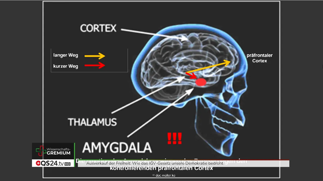 Analyse zu Risiko, Risikowahrnehmung und IGV-Gesetz - Interview mit Dr. med. Kurt Müller, Mitglied des QS24 Wissenschafts-Gremiums 6 Präsentationsfolie: Kopfquerschnitt mit hervorgehobener Amygdala, Beschriftungen 'Cortex', 'Thalamus' und 'Amygdala', Pfeile zu präfrontalem Cortex.