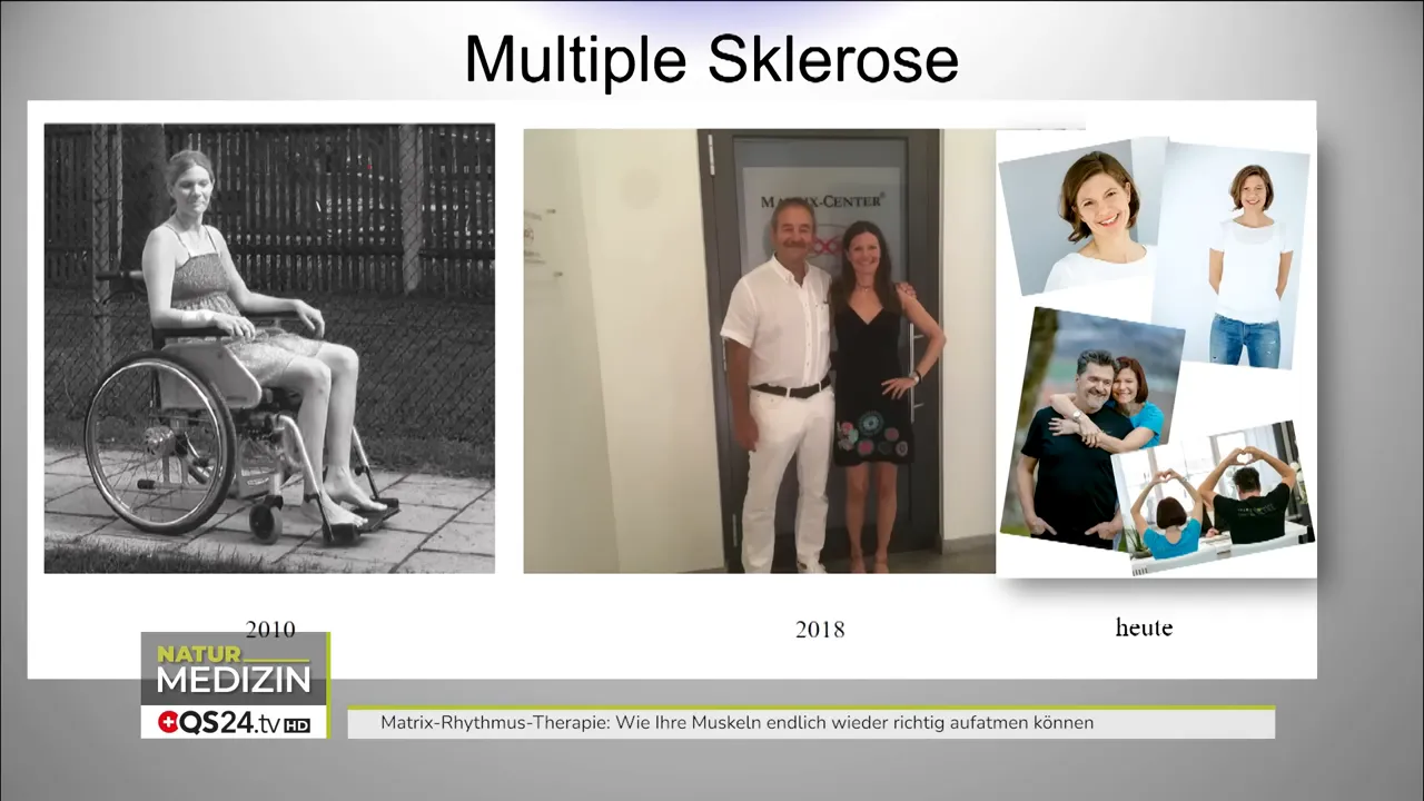Wie Ihre Muskeln wieder aufatmen können - Interview mit Dr. Ulrich Randoll, Begründer der Matrix‑Rhythmus‑Therapie 6 Präsentationsfolie 'Multiple Sklerose' mit Vorher‑/Nachher‑Fotocollage und Datumsangaben