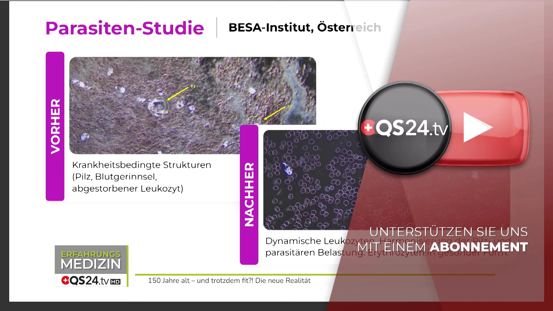 Studienergebnisse: Parasitäre Belastung und biologisches Alter