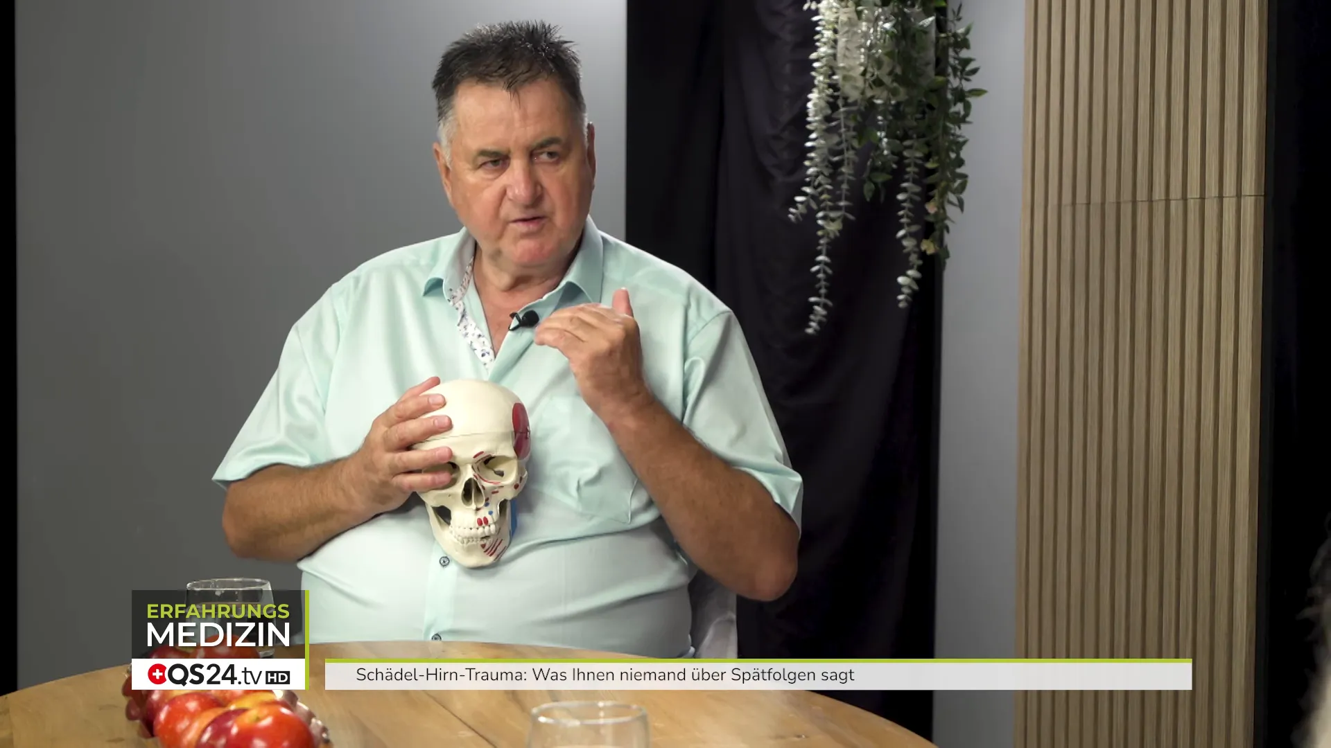 Grafik: Dreidimensionale Verschiebungen am Schädel