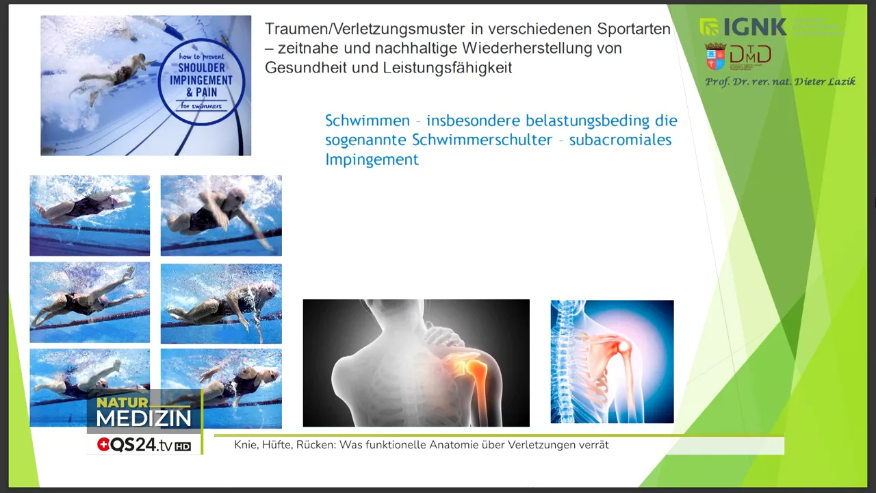 Schwimmer in Bewegung, Belastung der Schulter