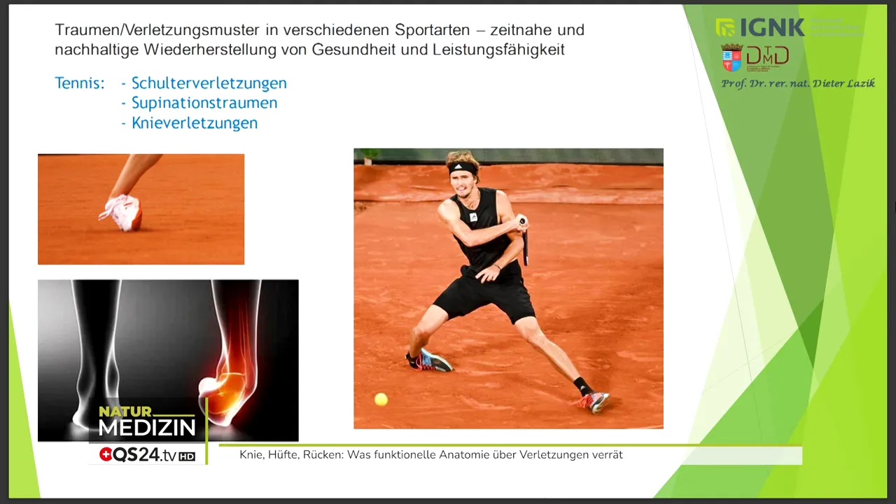 Umgeknickter Fuß, laterale Bandverletzung