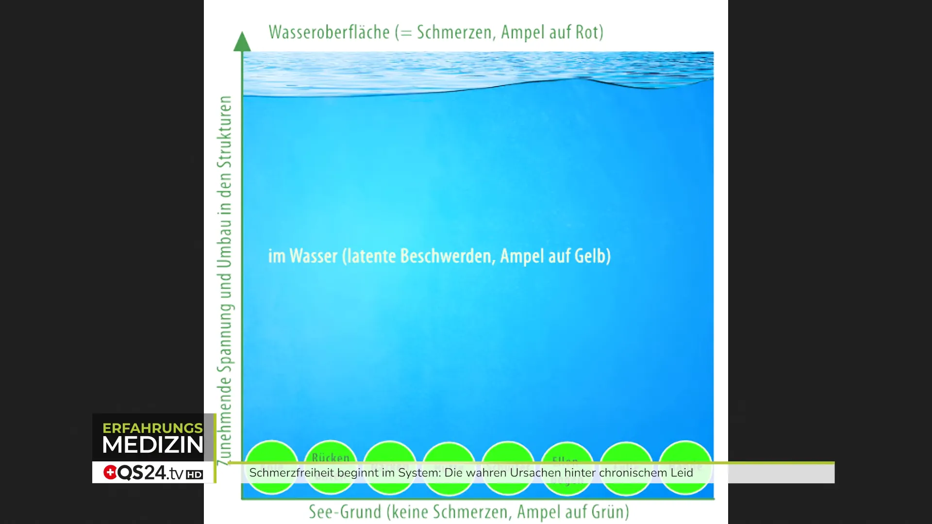 Schmerz-See: Bälle im See als Metapher für Gelenke und Schmerzoberfläche