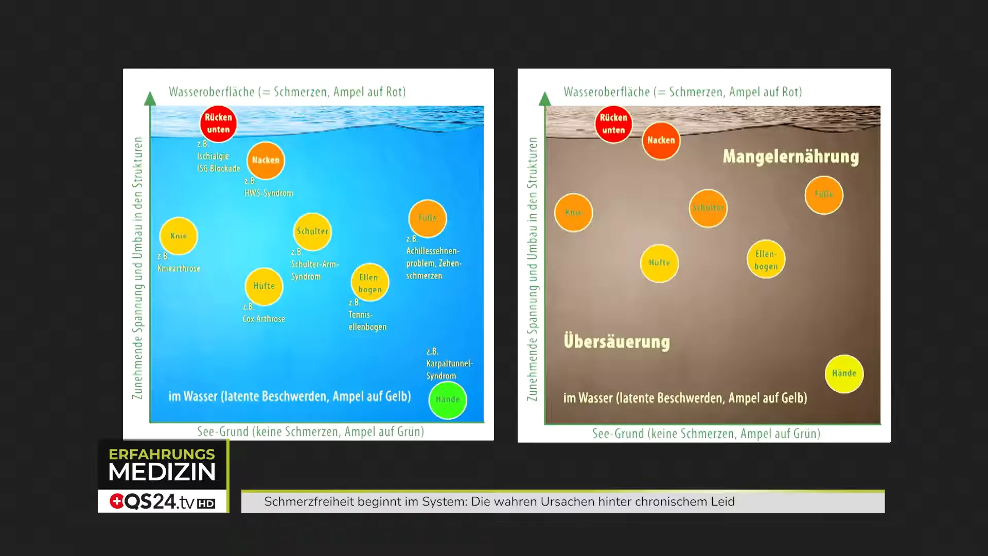 Themen: Vitamin D, Übersäuerung und Ernährung als Mitverursacher von Schmerzen