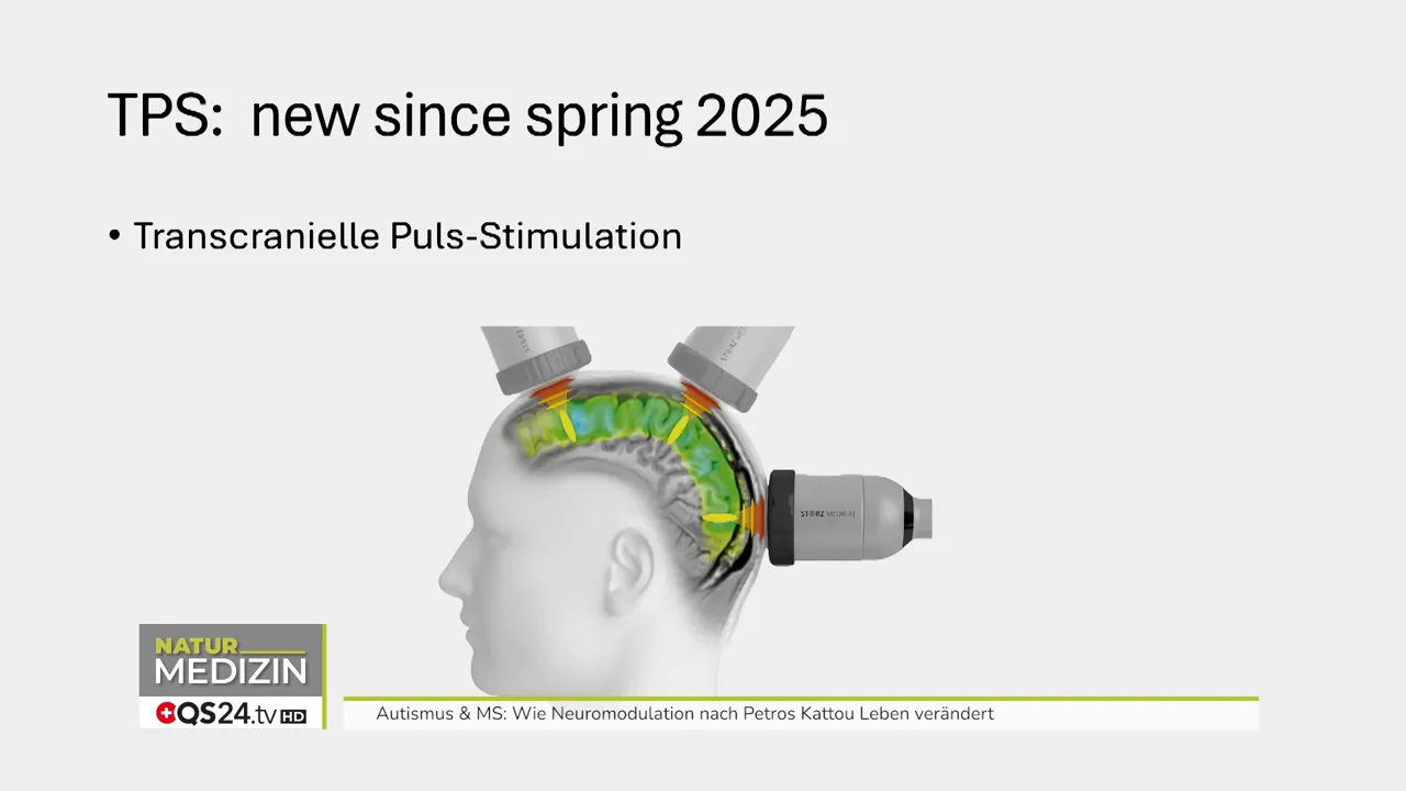 Behandlungsplanung anhand von MRT-Bildern am Gerät