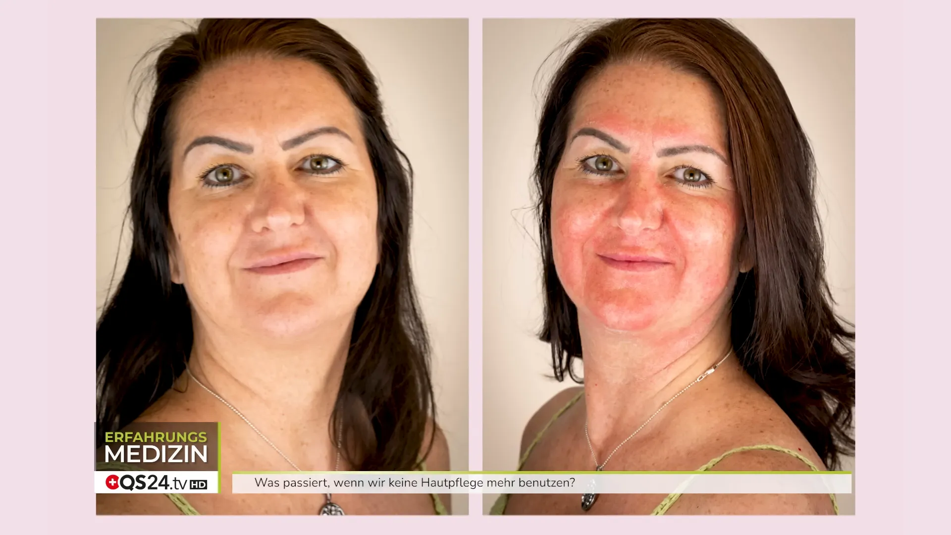 Stoffwechselaktivierung wird mit Hautsport verglichen