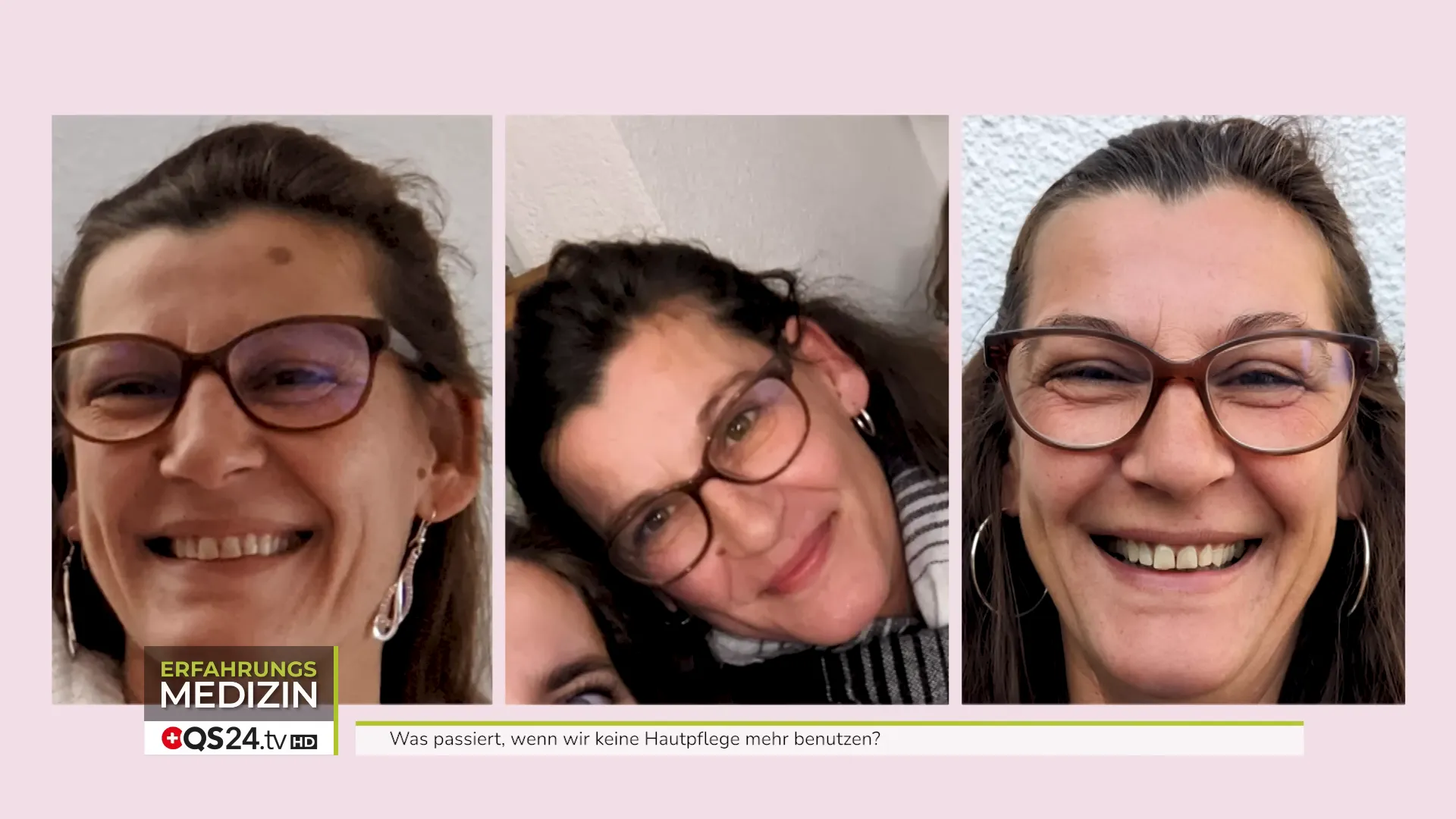 Pigmentfleck verblasst durch gezielte Pflege