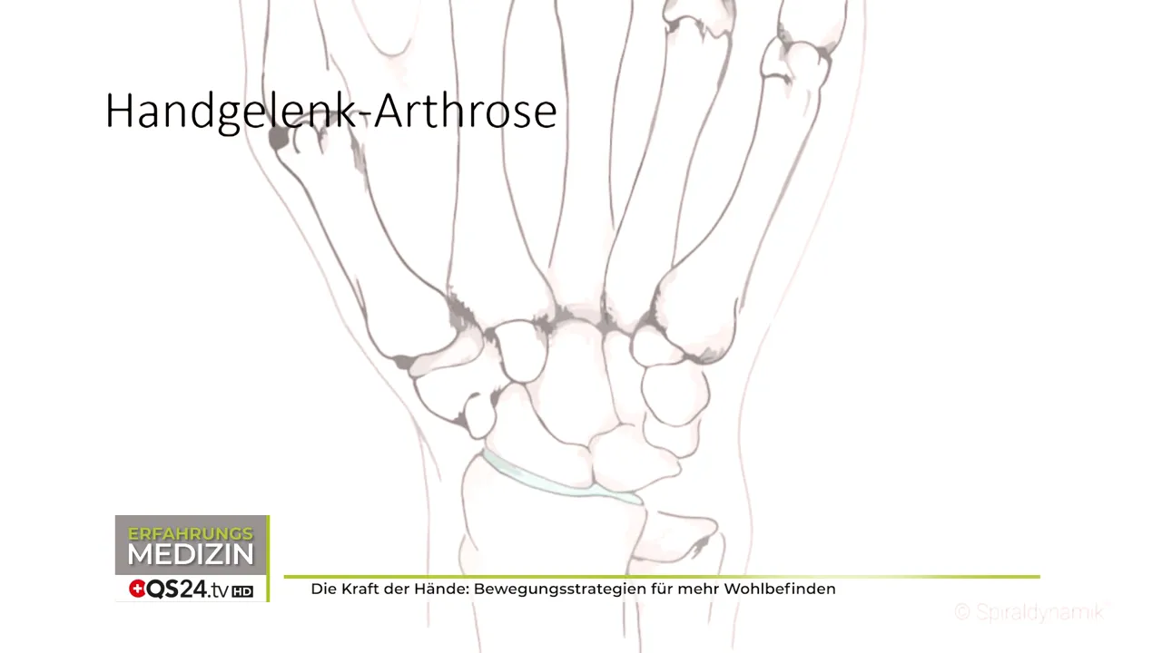 Die Kraft der Hände - Interview mit Dr. med. Christian Larsen, Mitbegründer der Spiraldynamik 6 Grafik: Karpaltunnel und Sehnenverlauf