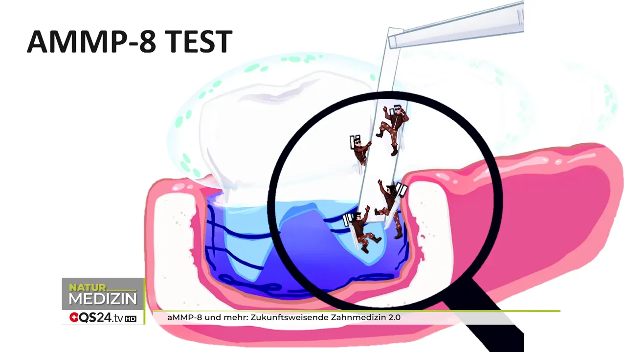 aMMP‑8 Test: Immunologische Früherkennung