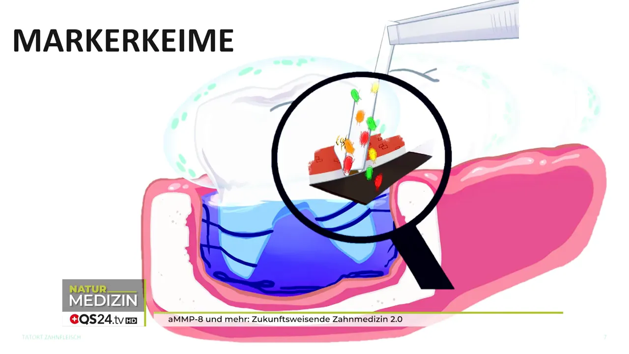 Bakterienvielfalt im oralen Mikrobiom