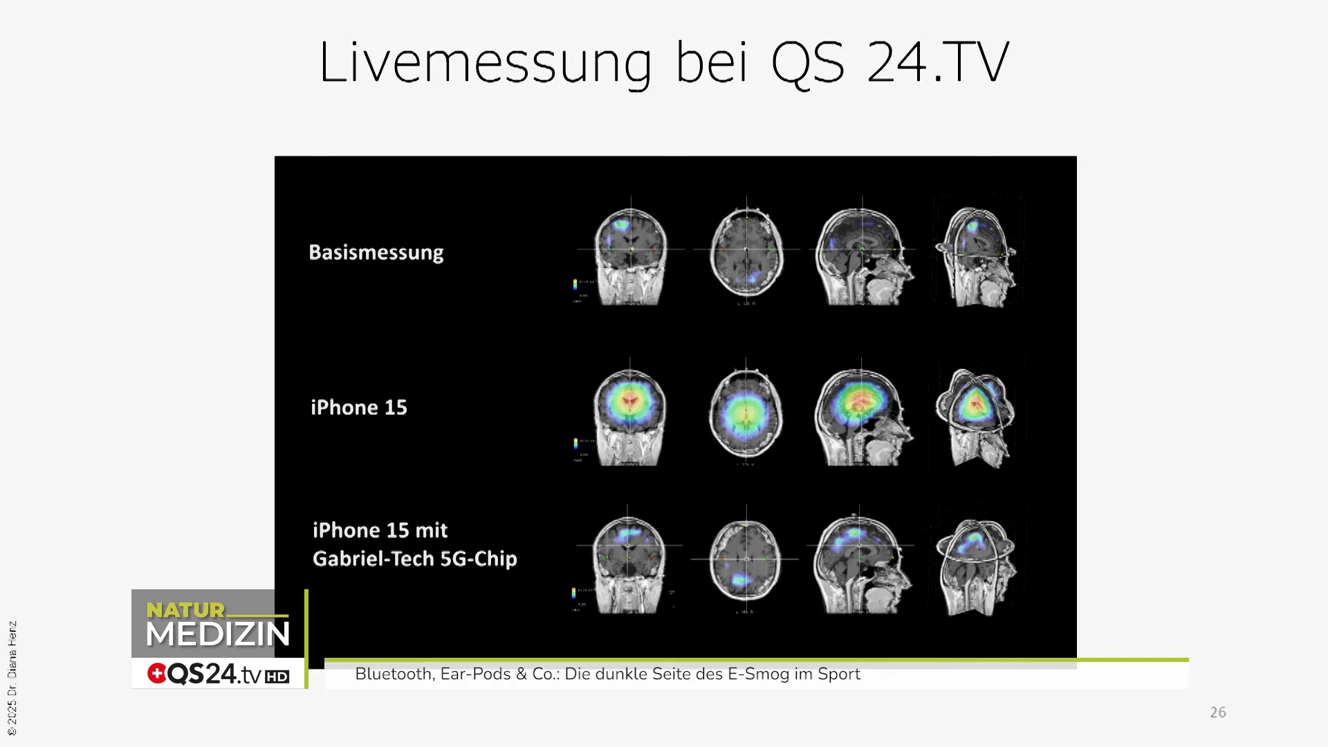 Live‑Messung im Studio: EEG‑Aufbau bei Proband