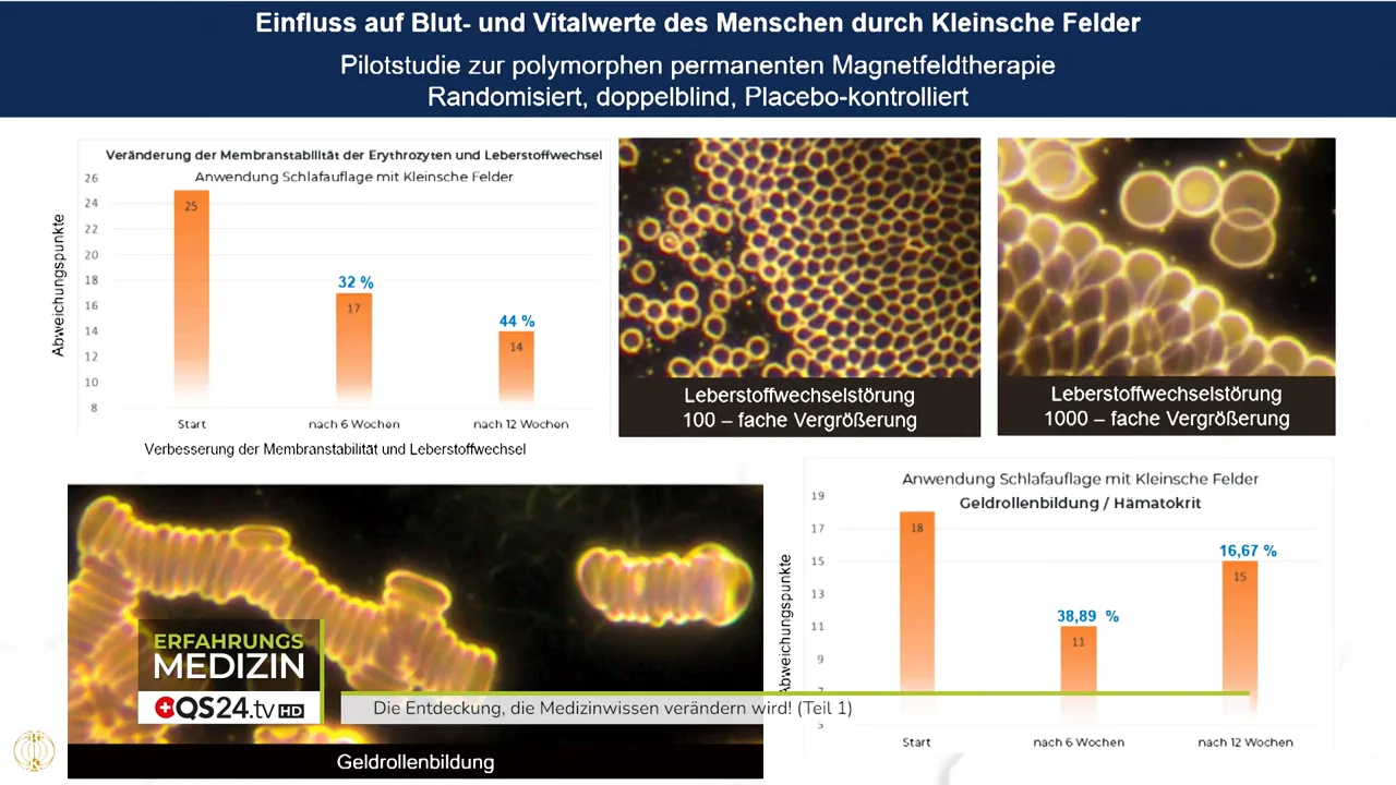 Dunkelfeld: Geldrollenbildung vs. normale Erythrozyten