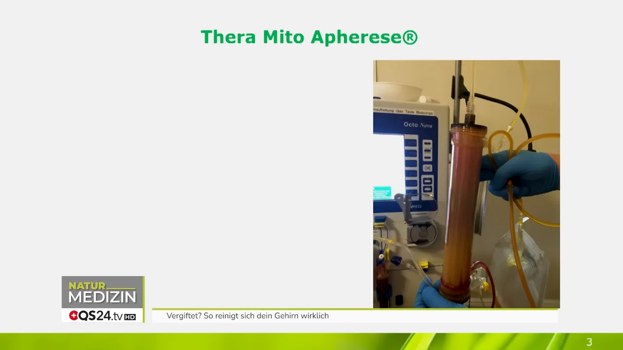 THERA Mito Apherese®: Vorher-nachher verfärbter Filter mit sichtbarer Belastung im Plasma