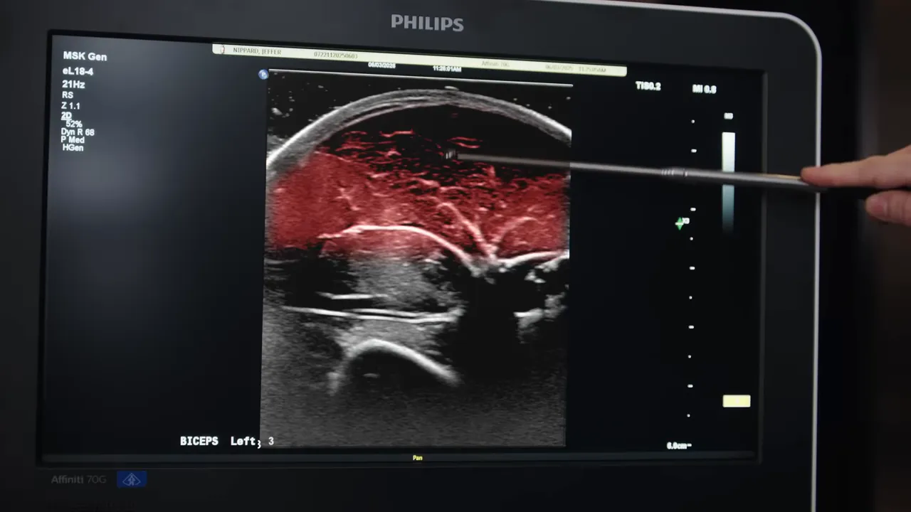 Ultrasound image with biceps muscle tissue highlighted in red and labeled muscle