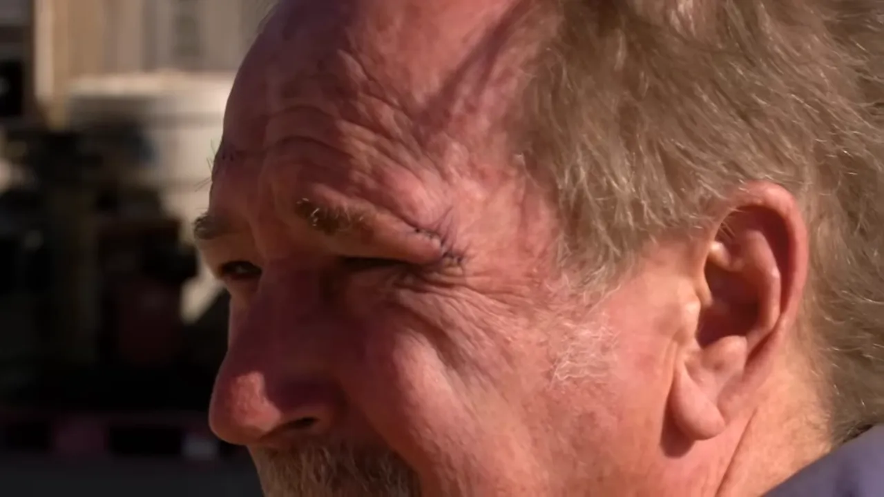 Steve at the clinic getting stitches removed