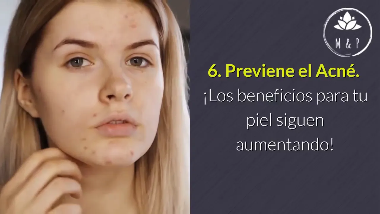 Prevención del acné con agua caliente