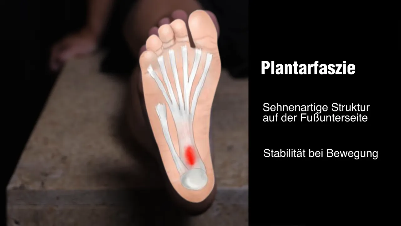 Illustration der Plantarfaszie mit markierter Schmerzstelle und Funktion Stabilität bei Bewegung