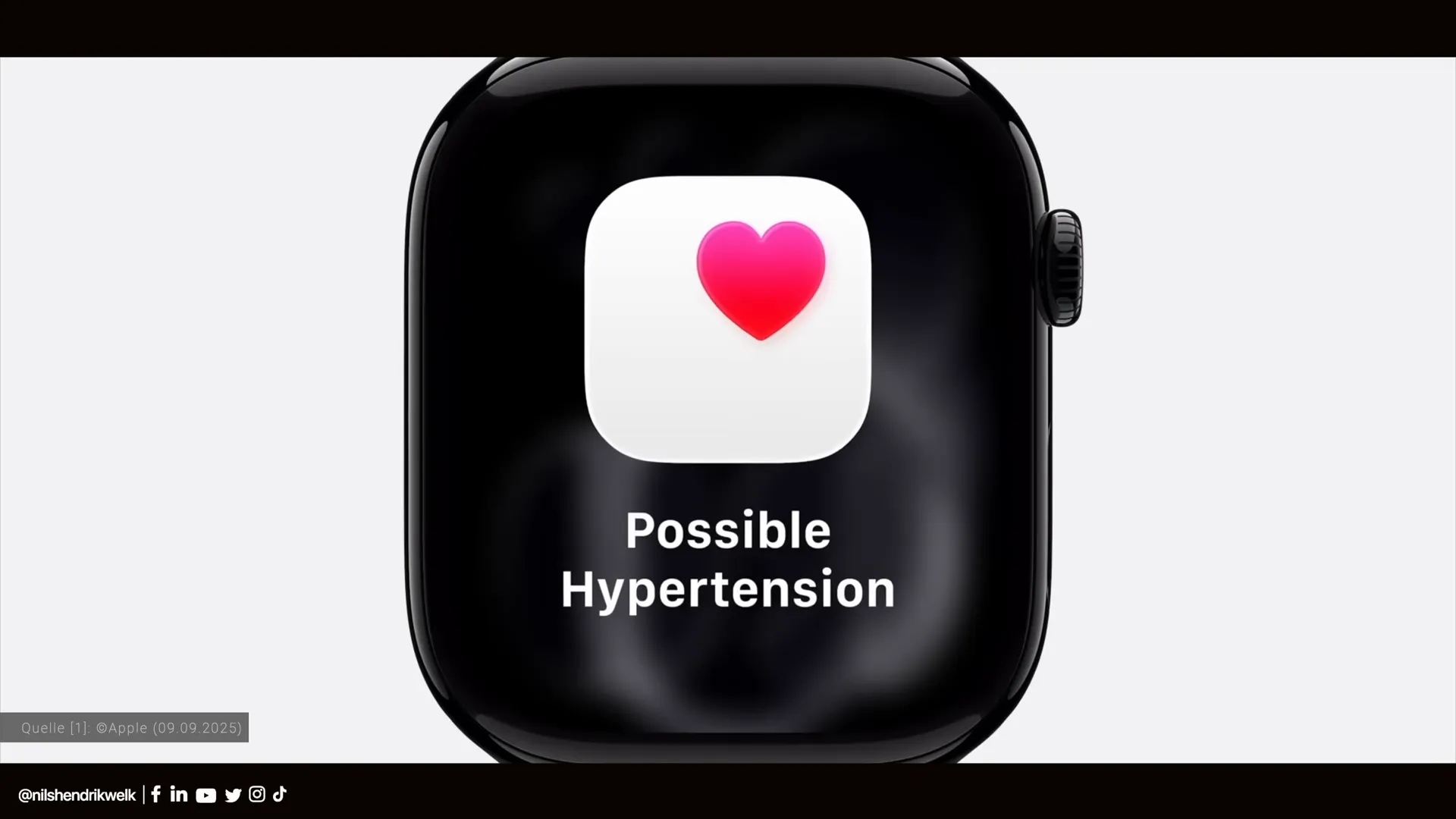 Apple Watch Series 11 auf der Bühne