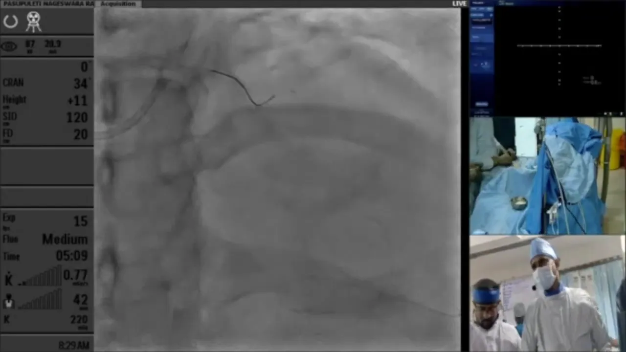 Initial CT scan evaluation