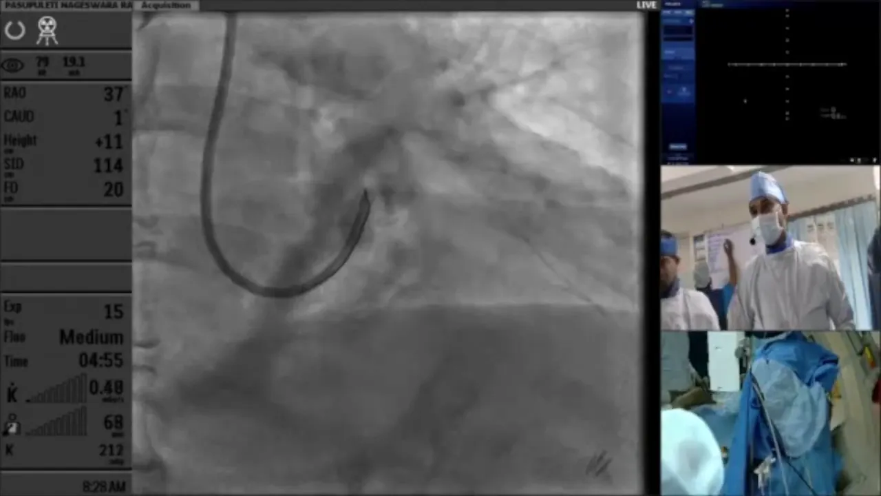 CT angiogram showing calcification