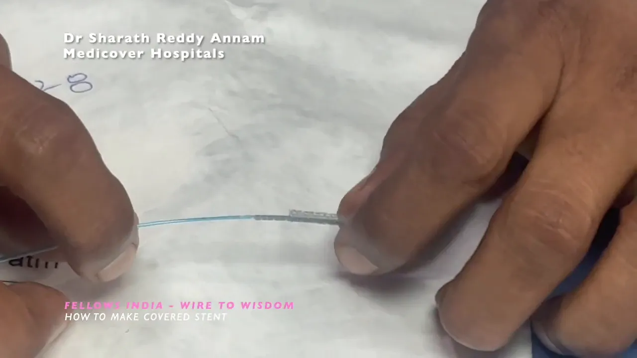 Close-up of a short coronary stent on a wire with balloon film beneath the stent frame ready for assembly