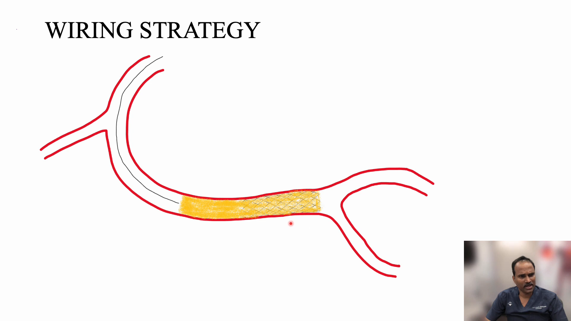 Wiring strategy using directable wire