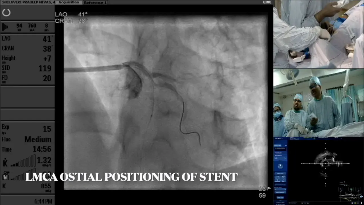 Real-time imaging during stent deployment