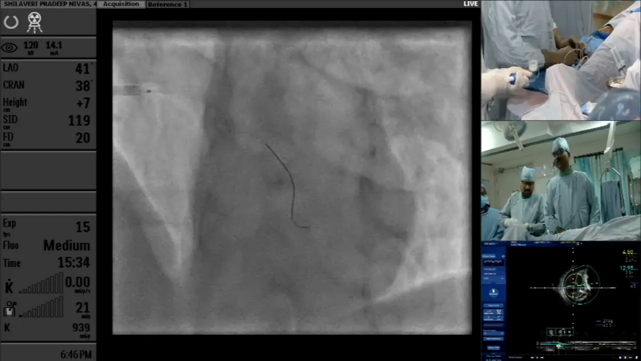 Post-deployment evaluation of stents