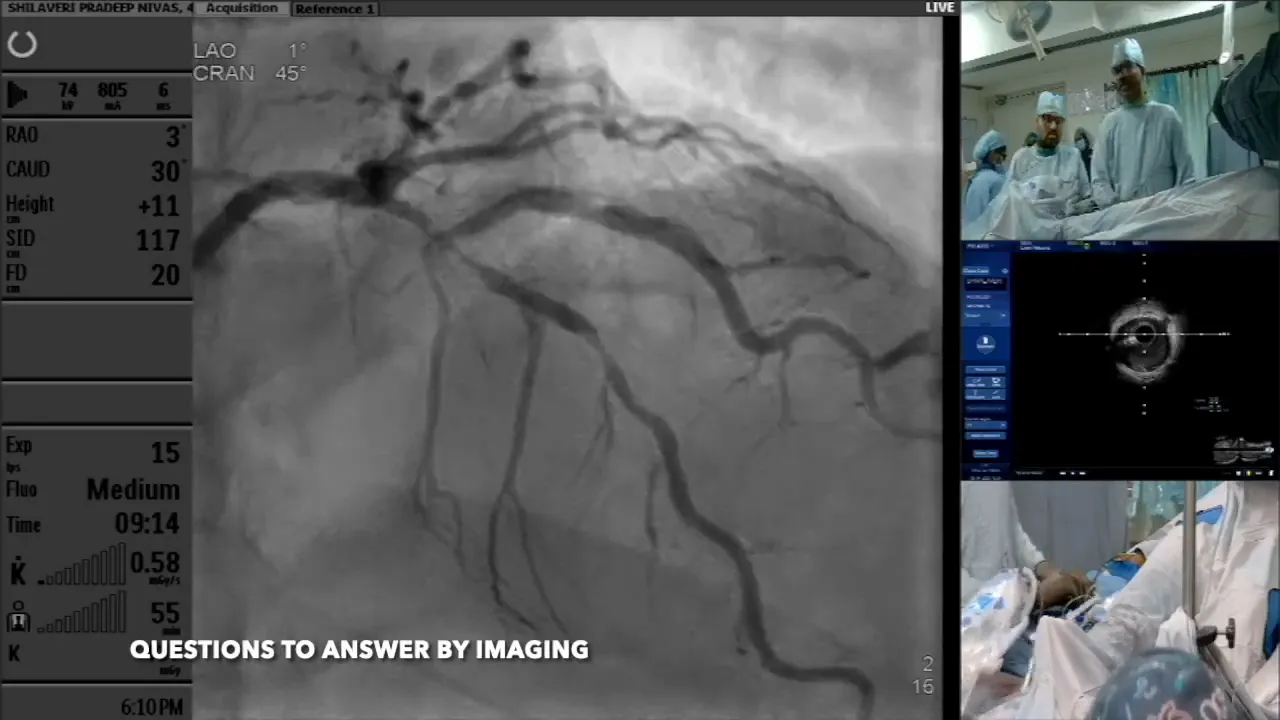 Assessing proximal ostium and plaque extension