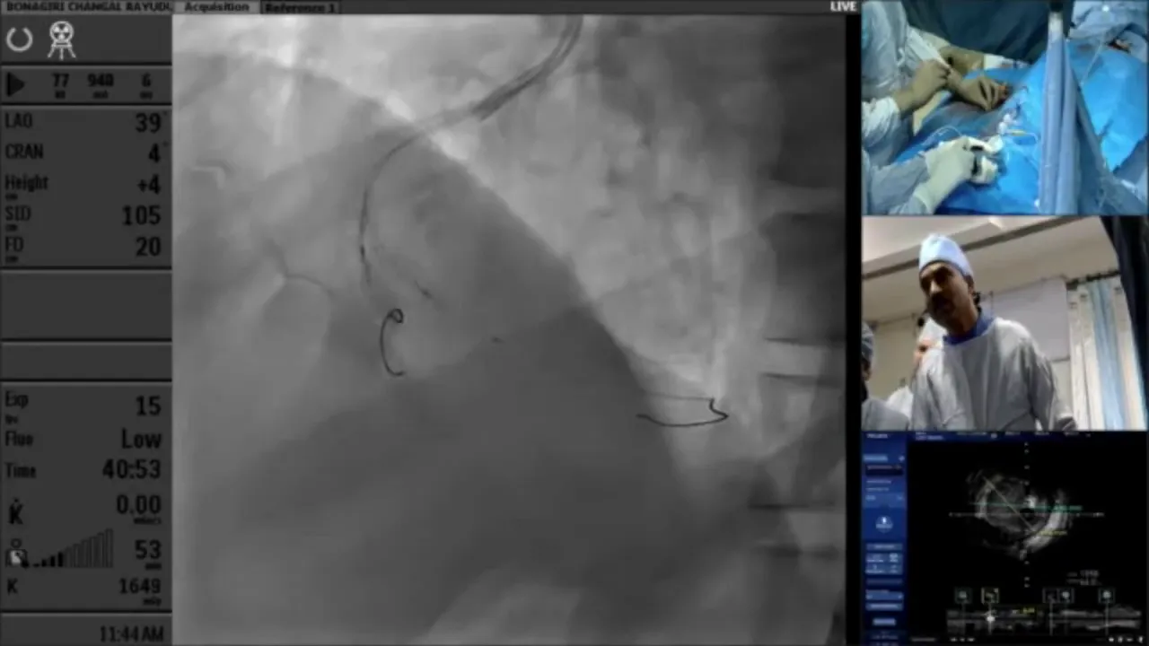 Balloon inflation during vessel preparation for stenting