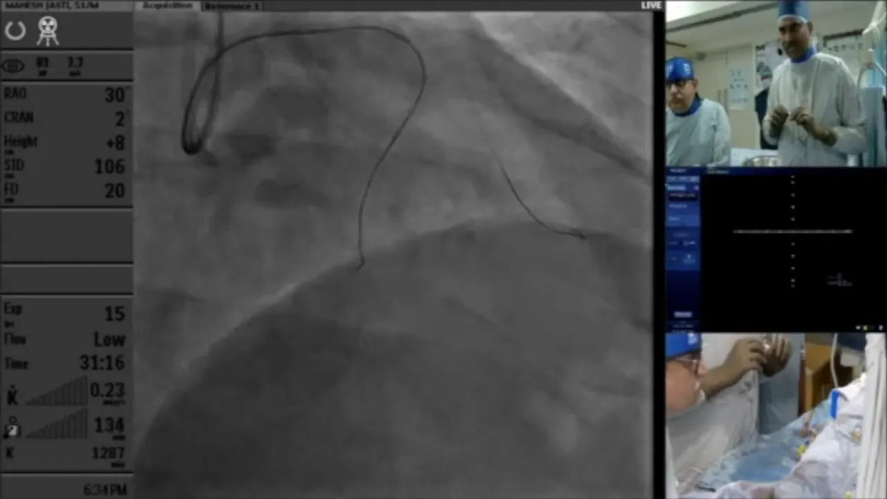 ECG analysis during wire navigation