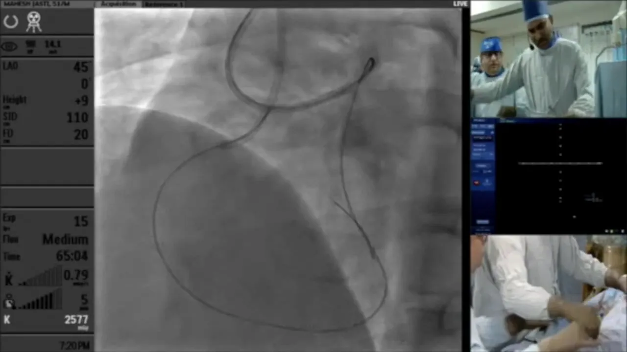 Assessing hemodynamics during intervention