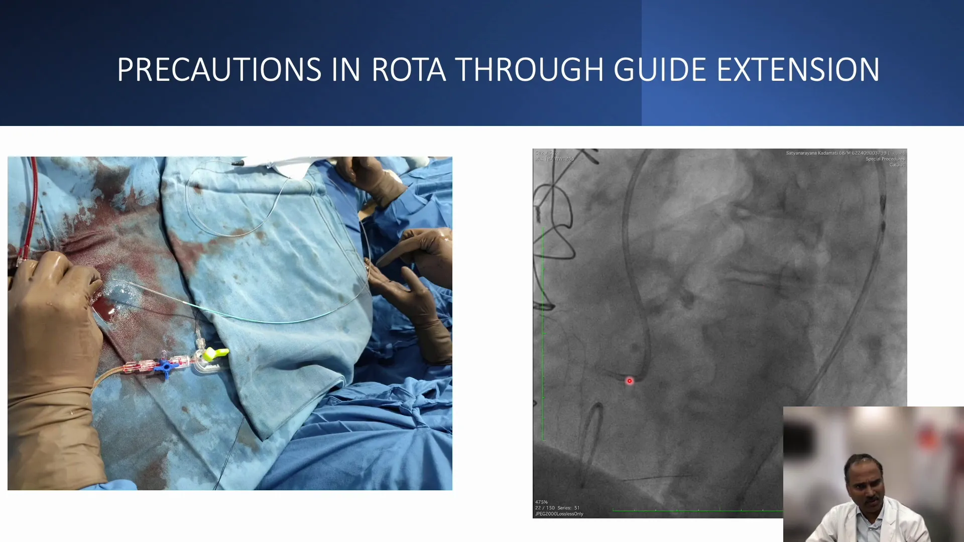 Loading Rota to Guide Extension