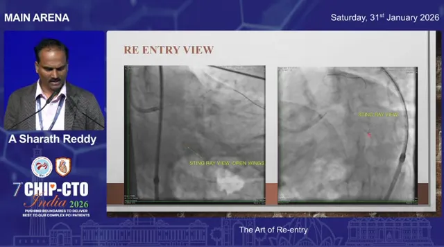 Clear lecture slide labeled 'RE ENTRY VIEW' with two angiographic panels showing the Stingray balloon relationship to the lumen